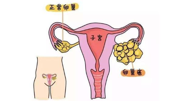 重庆市中医院老中医说月经常有这个问题，大多是卵巢癌造成的。