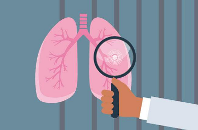 远离肺癌，御和堂中医推荐5种最简单的养肺方法！