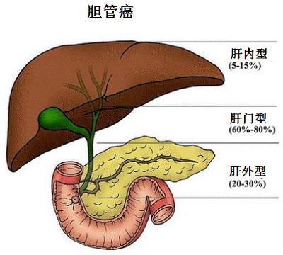 重庆肿瘤专科医院|减轻胆管癌晚期病人痛苦的护理方式有哪些?可以采取中医吗