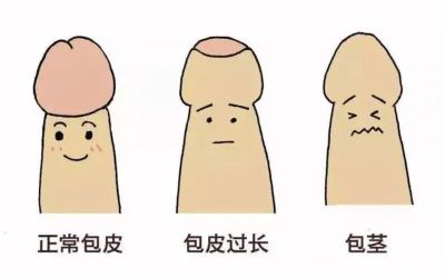 重庆中医肿瘤专家:包皮过长与阴茎癌有什么关系