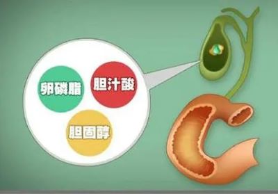 重庆中医肿瘤专家解读胆囊癌的症状与体征
