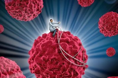 重庆中医肿瘤专家:癌症患者的锻炼方式有哪些？